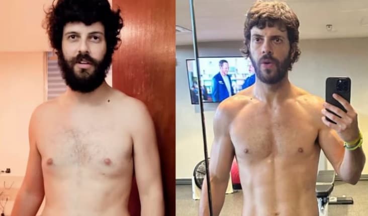 Diogo Defante faz ‘antes e depois’ e revela retirada de tumor: ‘Quase entrei em depressão’