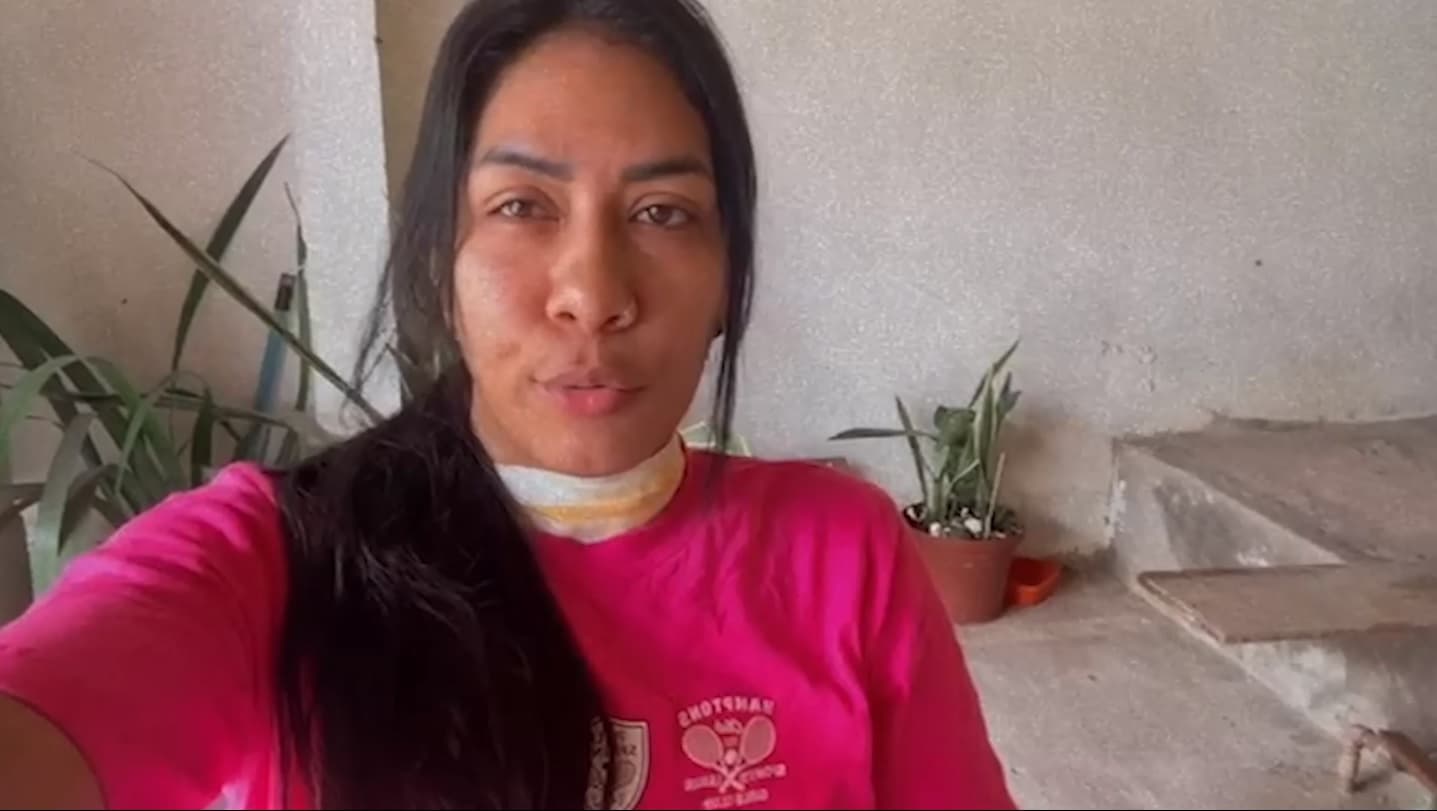 Caso de mulher ferida por linha de cerol acende alerta para os perigos do artifício