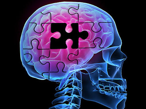 Cientistas já podem identificar Alzheimer antes dos sintomas