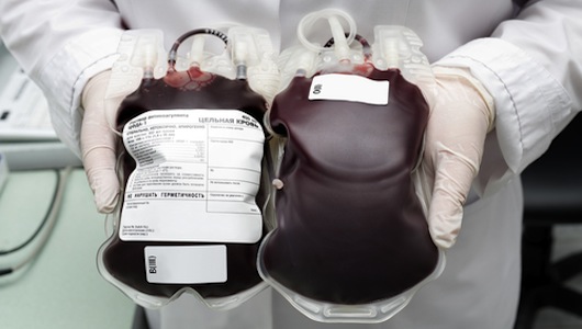 Estudo conclui que cirurgias cardíacas tem melhor resultado sem transfusões de sangue Estudo conclui que cirurgias cardíacas tem melhor resultado sem transfusões de sangue