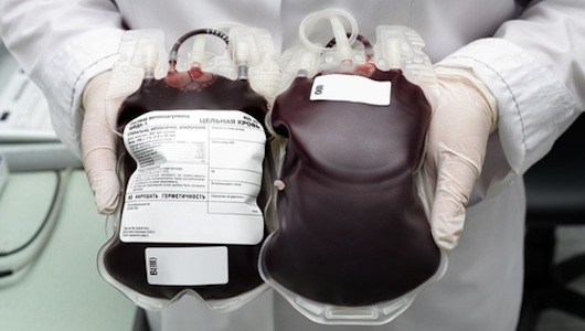 Estudo conclui que cirurgias cardíacas tem melhor resultado sem transfusões de sangue