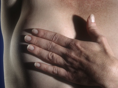 Metade dos casos de câncer de mama diagnosticados por ano está em estágio avançado, diz médica