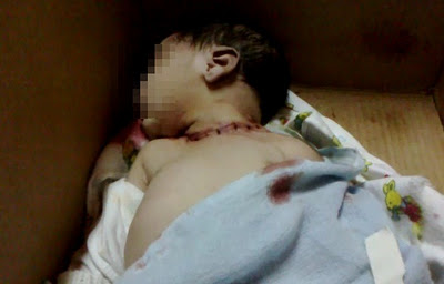 Caso de bebê degolado em Chapadinha não é o único no Maranhão