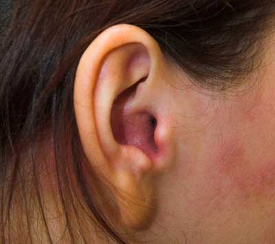Casos de otite externa aumentam no verão
