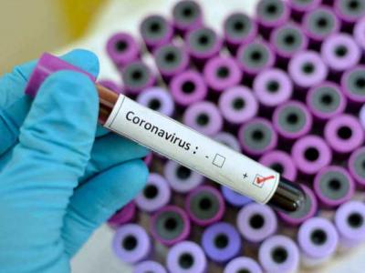 Sobe para 31 o número de casos de coronavírus no MA