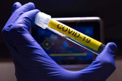 mão usando luvas segura tubo com amostra de coronavírus
