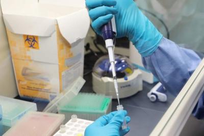Covid-19: testes com vacina de Oxford começam em São Paulo