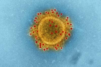 Covid-19: MA tem 836 casos confirmados e 6 mortes nas últimas 24h 