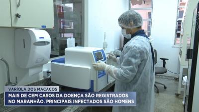 MA já tem 100 casos confirmado de varíola dos macacos