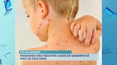 Maranhão não registra casos de sarampo desde 2021