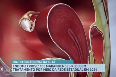 Dia da luta contra endometriose: saiba os sintomas mais frequentes