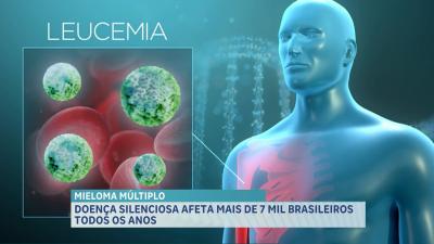 Conheça o mieloma múltiplo um câncer que se desenvolve na medula óssea