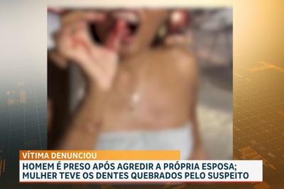 Guarda Civil prende suspeito de agredir companheira no Anel Viário, em São Luís