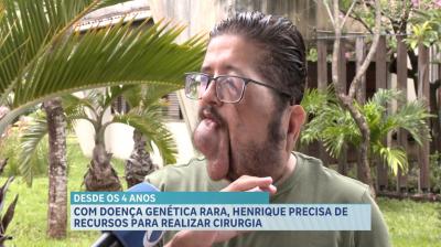 Com doença genética rara, Henrique Broker precisa de recursos para realizar cirurgia