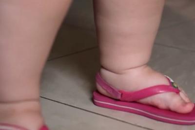 No Maranhão, mais de 24 mil crianças foram diagnosticadas com obesidade em 2024