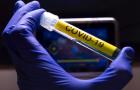 Covid-19: crianças menores de 5 anos são quase metade dos hospitalizados