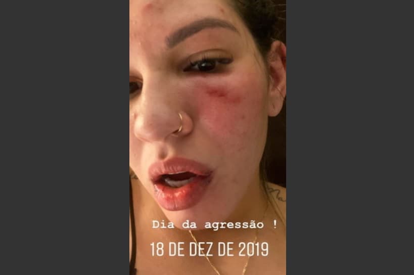 Ex-mulher de Jean divulga novas fotos da agressão para se defender