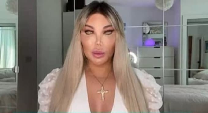 Ex-Ken Humano vai se chamar 'Jéssica' e quer adotar um bebê