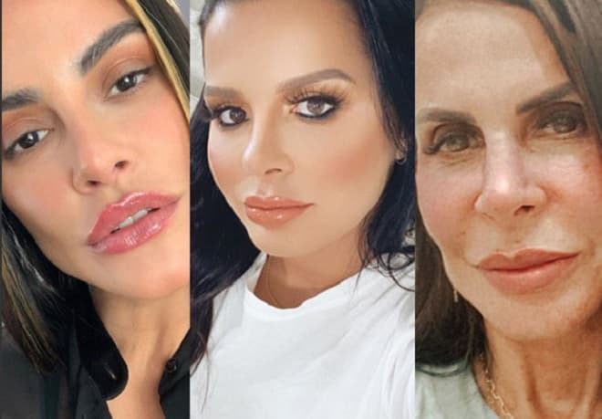 Exageraram? Relembre famosas criticadas por excesso de plásticas