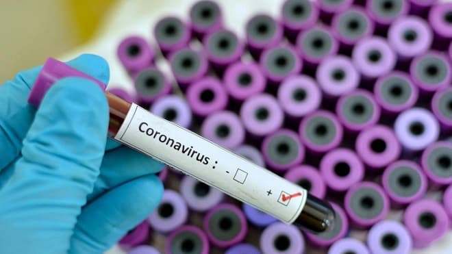 MA registra 4ª morte e casos de Covid-19 sobem para 132