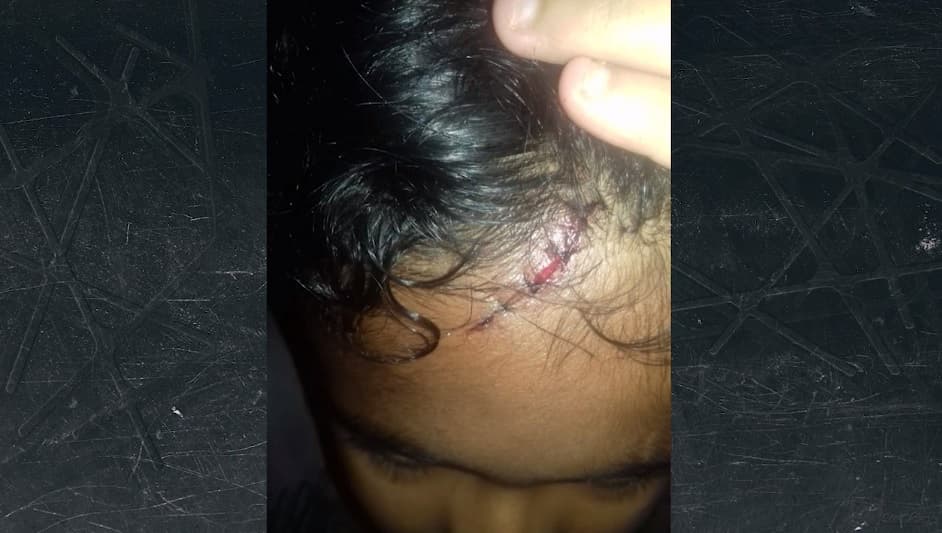 Filho é agredido pelo pai ao tentar defender a mãe em Codó