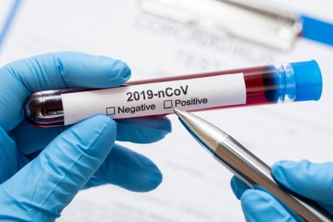 Número de testes positivos de Covid-19 é o maior em dois meses