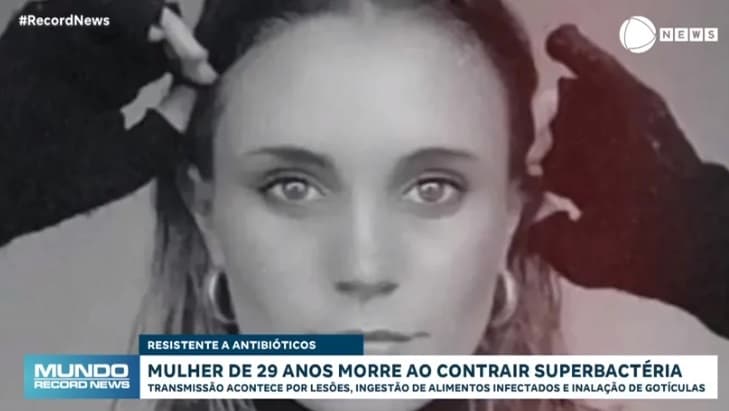 Australiana de 29 anos morre após contrair superbactéria comedora de carne