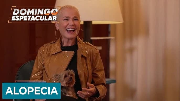 Xuxa revela como tem lidado com a alopecia e conta detalhes do transplante capilar