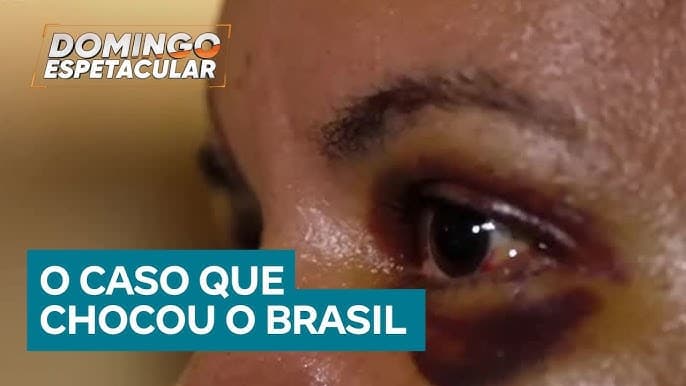 Vítima de agressões no elevador quebra o silêncio em entrevista exclusiva