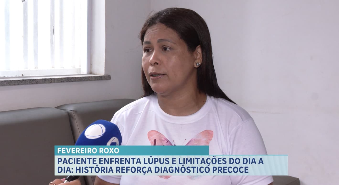 Paciente com lúpus enfrenta limitações diárias e reforça importância do diagnóstico precoce