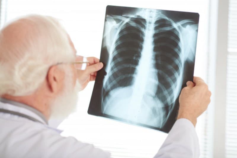 Médico, remédio, plano de saúde: o que é possível deduzir no IR 2020