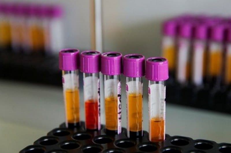 tubos de laboratório