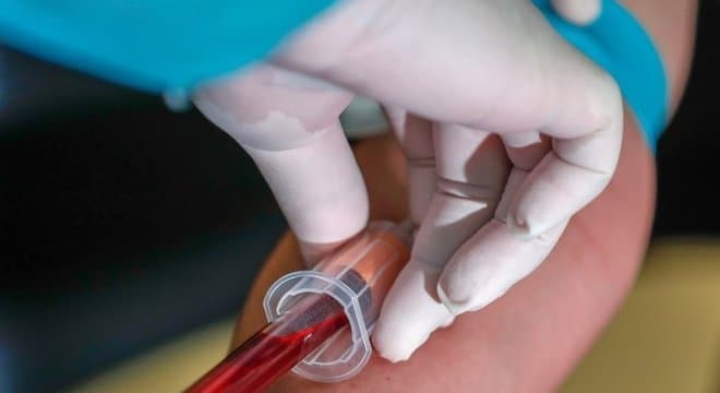 Estudo avalia potencial de quatro drogas no combate a Covid