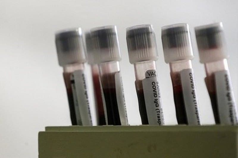Saúde reafirma que 1º caso de covid-19 foi confirmado em fevereiro