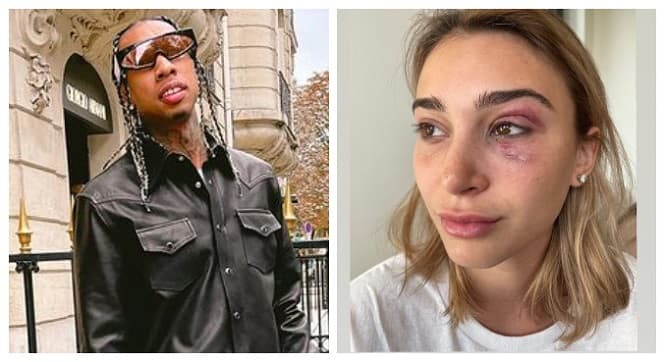 Rapper Tyga é acusado de agredir ex-namorada