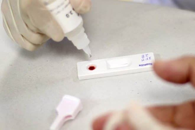 Sífilis: entenda o que é, qual a prevenção e o tratamento disponível no SUS