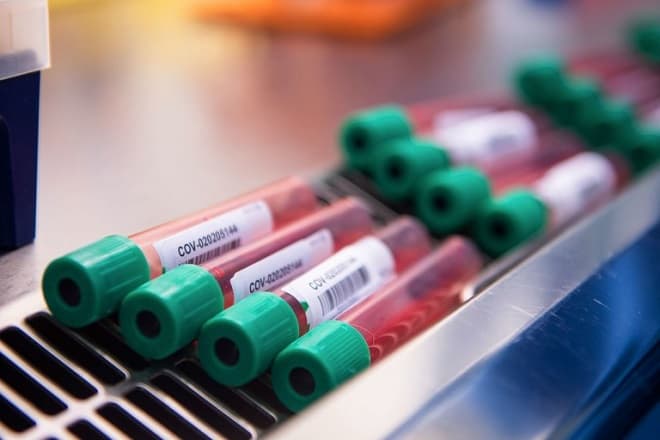 Anticoagulante inibe replicação do vírus da Covid-19