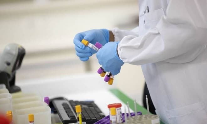 Maranhão ganha autonomia no diagnóstico molecular de arboviroses