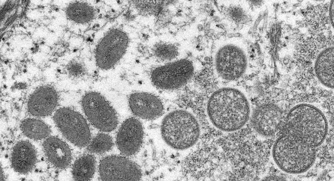 Sobe para 142 número de casos de varíola do macaco