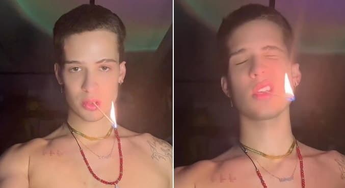 João Guilherme queima os cílios ao brincar com fogo
