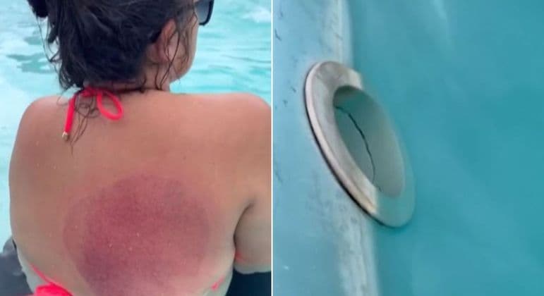 Jovem é aspirada e fica presa em bomba de sucção de piscina