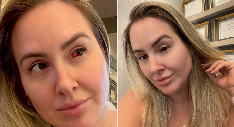 Ex-reality Patrícia Leitte revela ter sofrido derrame ocular