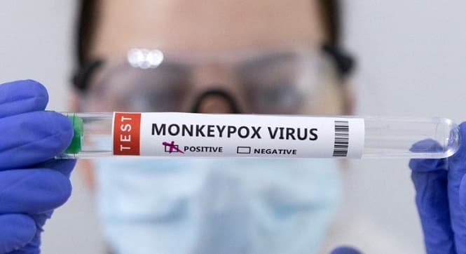 Anvisa autoriza uso emergencial de kits para varíola dos macacos