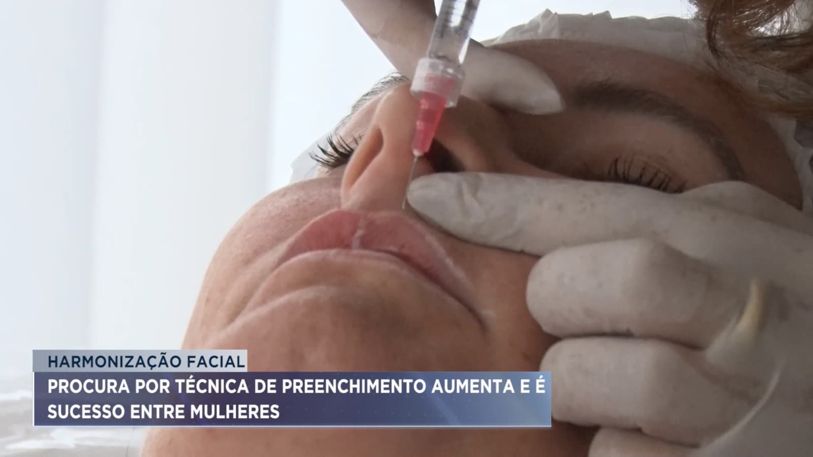 Harmonização facial deixa aparência mais jovem e eleva a autoestima