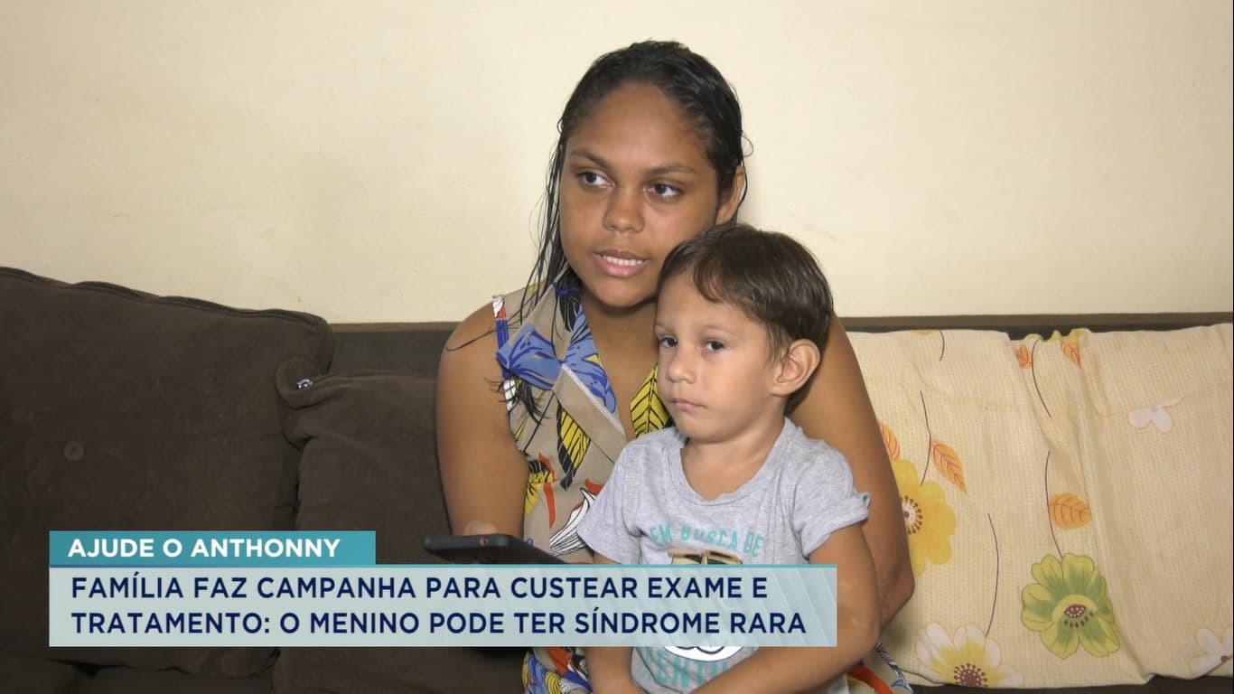 Família faz apelo por tratamento médico de criança com síndrome rara