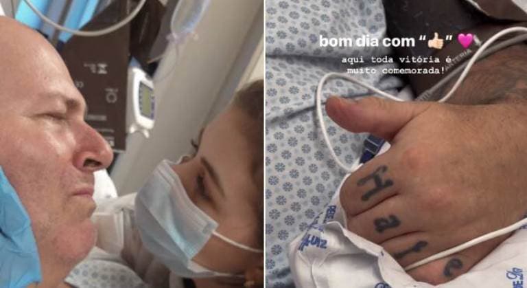 Filha mostra rosto de Mingau pela primeira vez desde que ele foi baleado