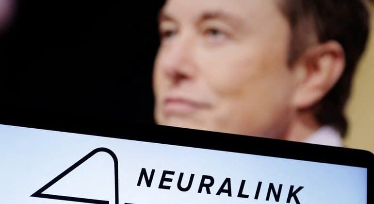 Elon Musk obtém aprovação para estudo de implantes cerebrais em humanos