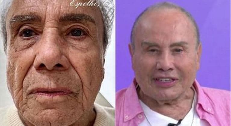 Harmonização facial de Stênio Garcia vira piada nas redes sociais