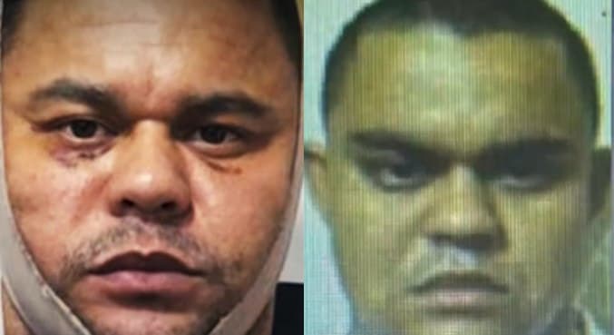 Criminoso faz cirurgia plástica para não ser identificado e acaba preso perto da clínica