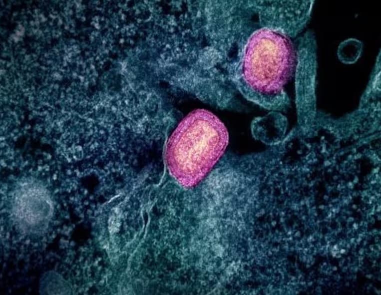Mpox não é ‘a nova Covid’, afirma diretor regional da OMS na Europa